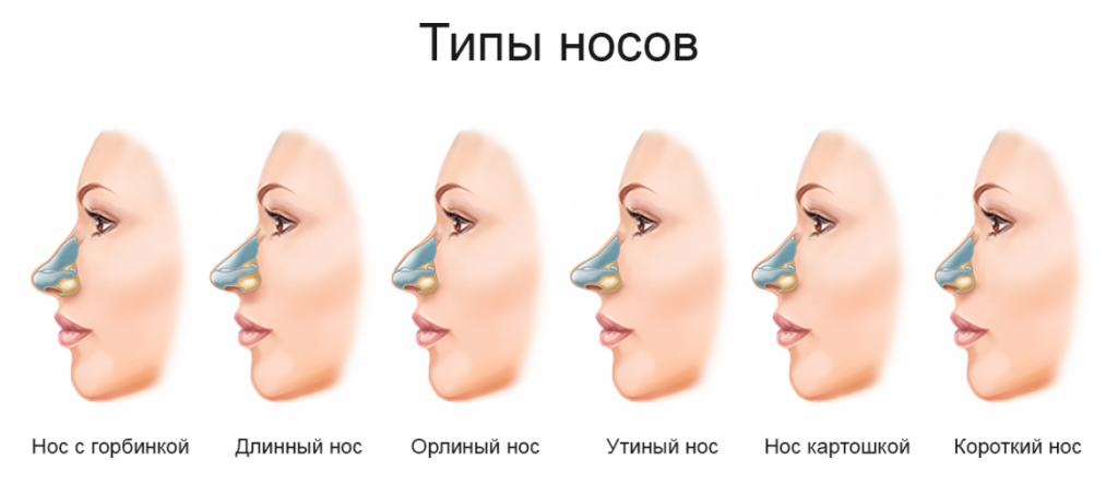 Причины искривления перегородки носа